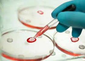 تشخیص باکتری مسمومیت‌زا در مواد غذایی با زیست‌حسگر محققان ایرانی