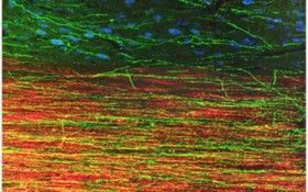 موفقیت دانشمندان در پرورش سلول‌های بنیادی انسان در نخاع موش‌ها