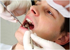 بیش از 90 درصد مردم درگیر مشکلات دهان و دندان هستند