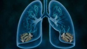 بیماری‌های تنفسی علت 13 درصد مرگ‌ومیرها در اتحادیه اروپا