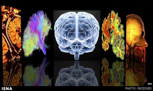 شناسایی نقطه‌ضعف مغز برای ابتلا به آلزایمر و اسکیزوفرنی