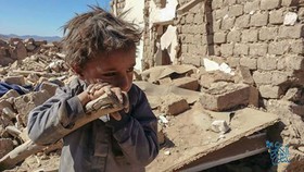 یمن در سال 2015 همراه با جنگ، خونریزی و تجاوز سعودی‌ها