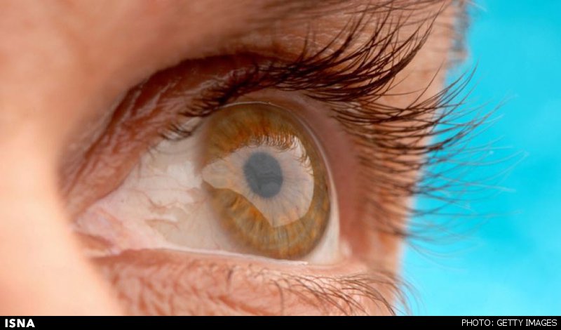 امیدی تازه برای درمان و پیشگیری‌ از بیماری‌های نابیناکننده‌ چشم