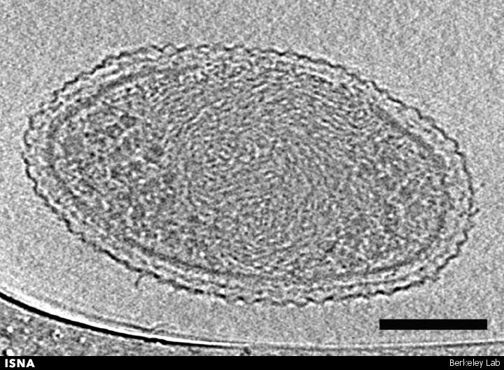 نخستین تصاویر میکروسکوپی دقیق از باکتری‌های فوق‌کوچک
