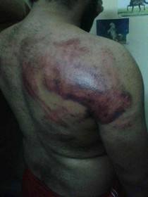 انتشار تصاویر شکنجه در زندان‌های آل‌خلیفه در بحرین