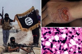 شیوع نوعی بیماری مرگبار در میان داعشی‌ها