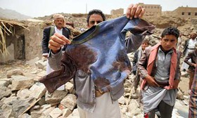 شمار قربانیان تجاوز ائتلاف سعودی به یمن از مرز 5400 تن گذشت