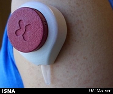 ابداعی دستگاهی برای خونگیری بدون درد