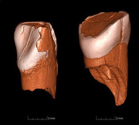 1429948073380_baby-teeth-tools.jpg