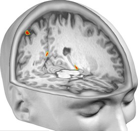 1430642361993_28340F0600000578-3064103-MRI_scans_revealed_that_specific_areas_of_the_brain_lit_up_like_-a-4_1430482343463.jpg