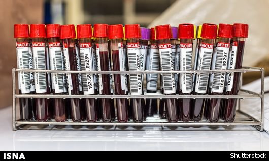 سلول‌های خون قاعدگی در درمان بیماری‌ها کاربرد دارد/ امکان اهدای سلول‌ها به خانواده