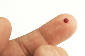 نمایش تاریخچه ویروس‌های انسان با آزمایش تنها یک قطره خون
