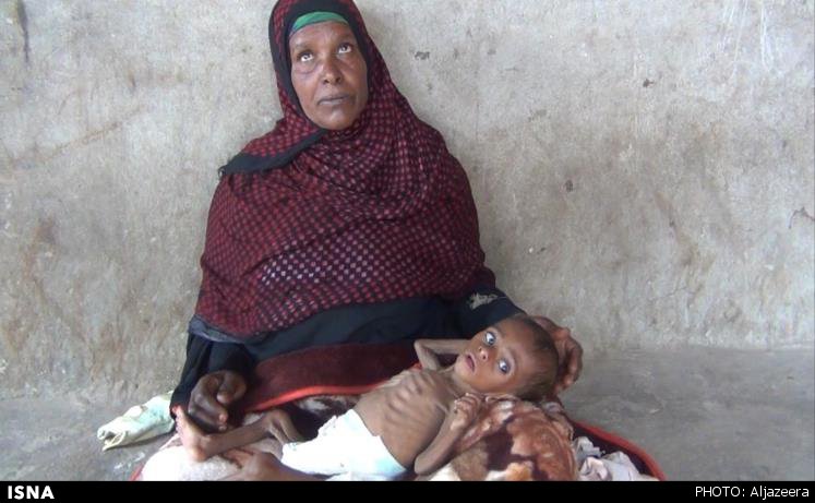 انواع بیماری‌ها و سوءتغذیه جان کودکان یمنی را تهدید می‌کند