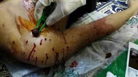 زخمی شدن ده‌ها تظاهرکننده بحرینی به ضرب گلوله نیروهای امنیتی