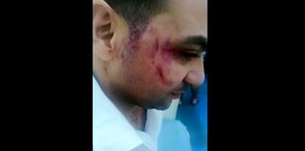 کتک زدن کارگر مصری توسط نماینده اردنی، امان را پاسخگو ساخت