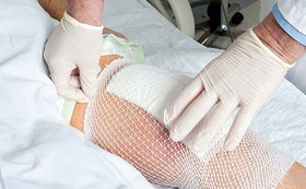 بررسی روش‌های نوین تسریع ترمیم زخم