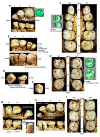 1448108417368_Homo-floresiensis-teeth.jpg