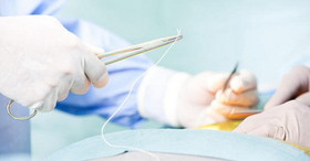 1449647858314_ran-630-sutures-shutterstock-630w.jpeg