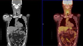 1459491568913_160330023955_pet-ct_scans_640x360_universityofbirmingham_nocredit.jpg