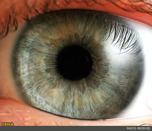 ساخت قطره‌ای برای درمان اختلالات چشمی ناشی از کهولت سن 1