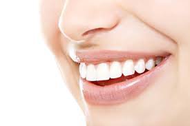 آنچه که باید درباره سفید کردن دندان‌ها بدانید