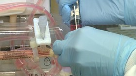 آزمایشگاهی در یک کیف دستی برای تشخیص سریع سرطان