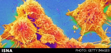 گرمادرمانی تومورها با نانوذرات و امواج ماکروویو
