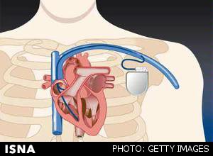 تولید نخستین ضربان‌ساز زیستی در بدن موجود زنده با تزریق ژن 1