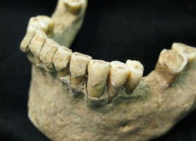 پلاک دندان هزار ساله،‌ رژیم غذایی قرون وسطی را آشکار کرد