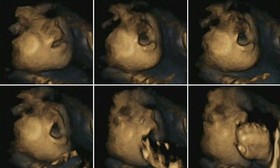 تصاویر سه‌بعدی خارق‌العاده از تکامل توانایی جنین در لمس صورت خود