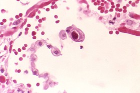 800px-Cytomegalovirus_01.jpg