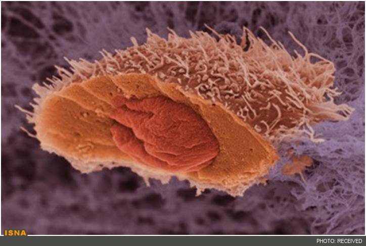 دارورسانی به سلول‌های سرطان پروستات با نانوقفس‌ها 