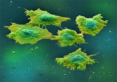 مرگ سلول سرطانی با نانوساختارهای ستاره‌ای‌شکل