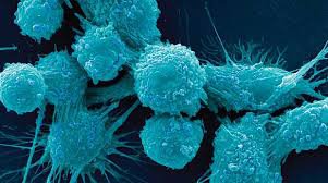 شناسایی سلول‌های سرطانی متاستاتیک با نانوبیوسنسور الکتریکی