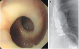 esophagus.jpg