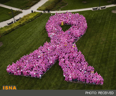 کشف ژن مرتبط با تومورهای خوش‌خیم سرطان پستان