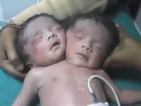 two-headed-baby.jpg