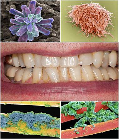 بیگانگان خطرناک ساکن دندان‌ها+تصاویر