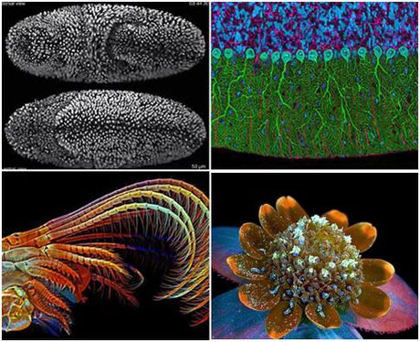 برترین تصاویر میکروسکوپی 2014 معرفی شدند