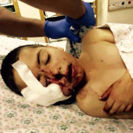 پلیس رژیم صهیونیستی به یک کودک 5 ساله فلسطینی شلیک کرد