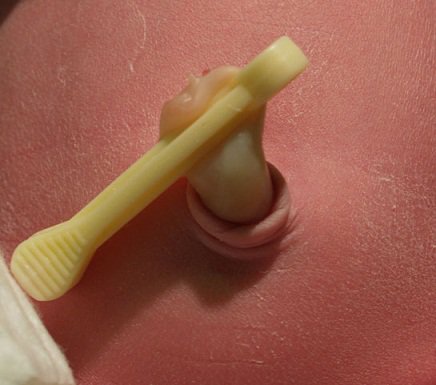 ارتباط زمان برش بند ناف و مهارت‌های اجتماعی پسران