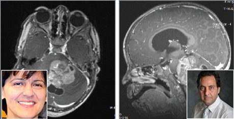 هدفگیری سرطان مغز کودکان با ترکیب دارویی محققان ایرانی