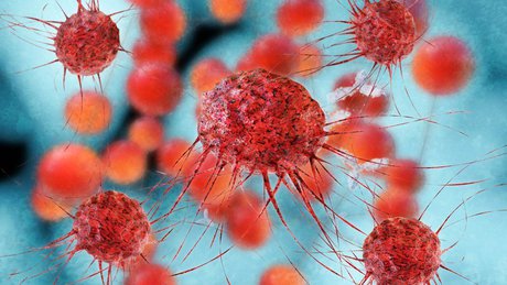 از بین بردن سلول‌های سرطانی در مدت 2 ساعت