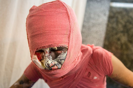 مصدومان چهارشنبه سوری - کرج