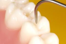 احتمال ورود نانومواد دندانپزشکی به بازار تا چند سال آینده