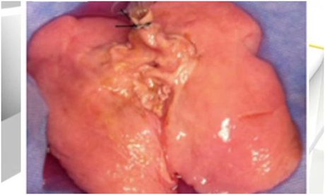 تولید ریه انسان در آزمایشگاه برای نخستین بار