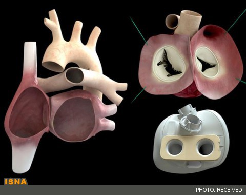 آزمایش بالینی قلب مصنوعی گاو- انسان 