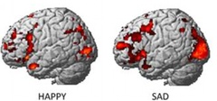 تشخیص شادی و غم افراد با اسکن مغزی!