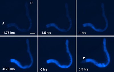 مشاهده مرگ آبی‌رنگ کرم‌ها، سرنخی برای افزایش امید به زندگی انسان