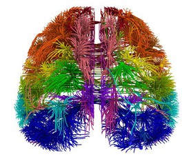 اولین نقشه سه‌بعدی از سیم‌کشی مغز یک پستاندار
